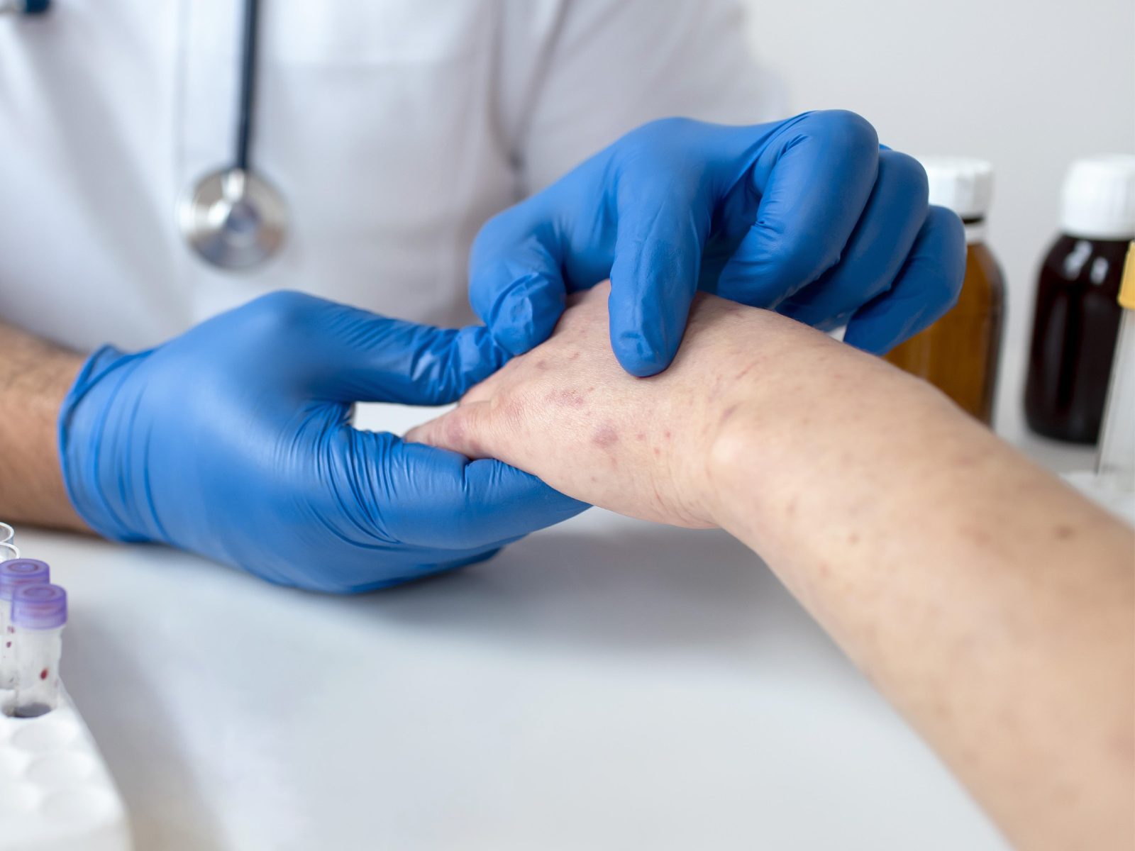 Examen allergie bras