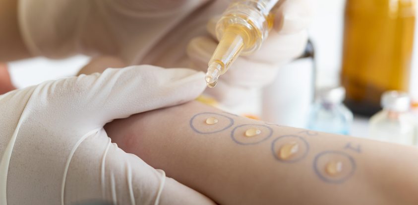 bilan allergologique