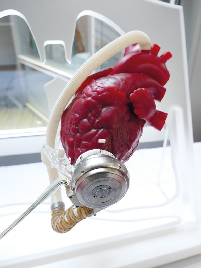 dispositif d'assistance ventriculaire sur une maquette de coeur 
