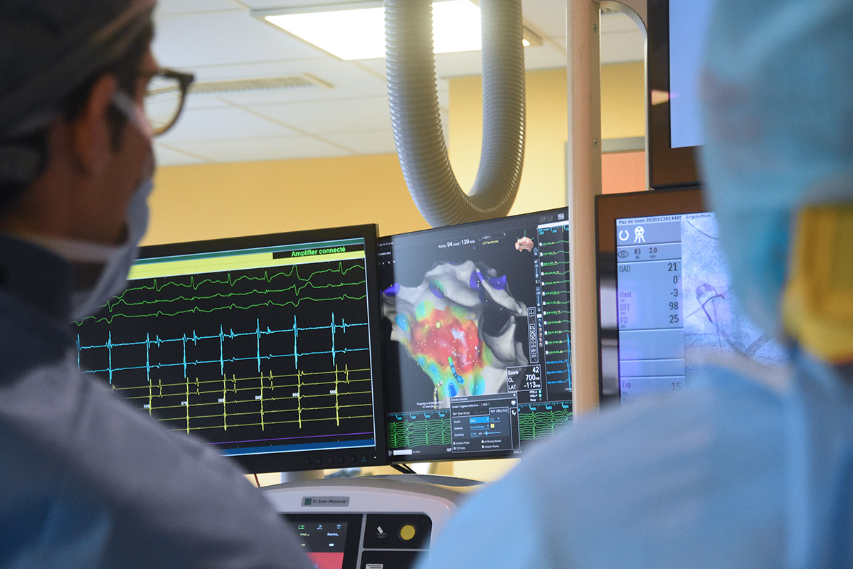 ablation de fibrillation atriale
