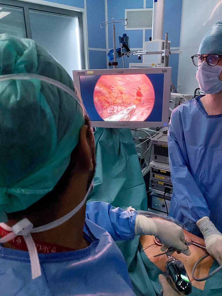 opération chirurgicale thoracique vidéo assistée