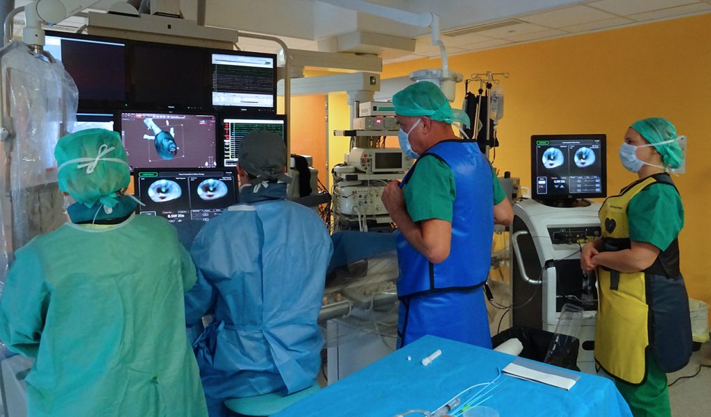 ablation de fibrillation atriale