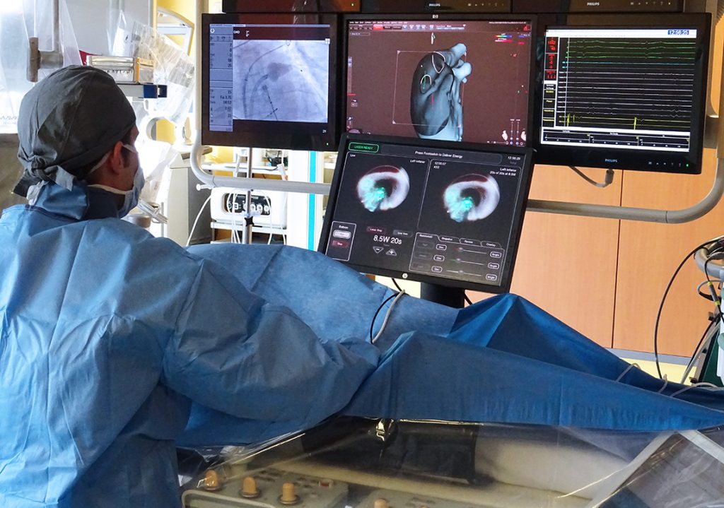 ablation de fibrillation atriale