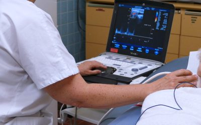 réalisation d'un écho doppler