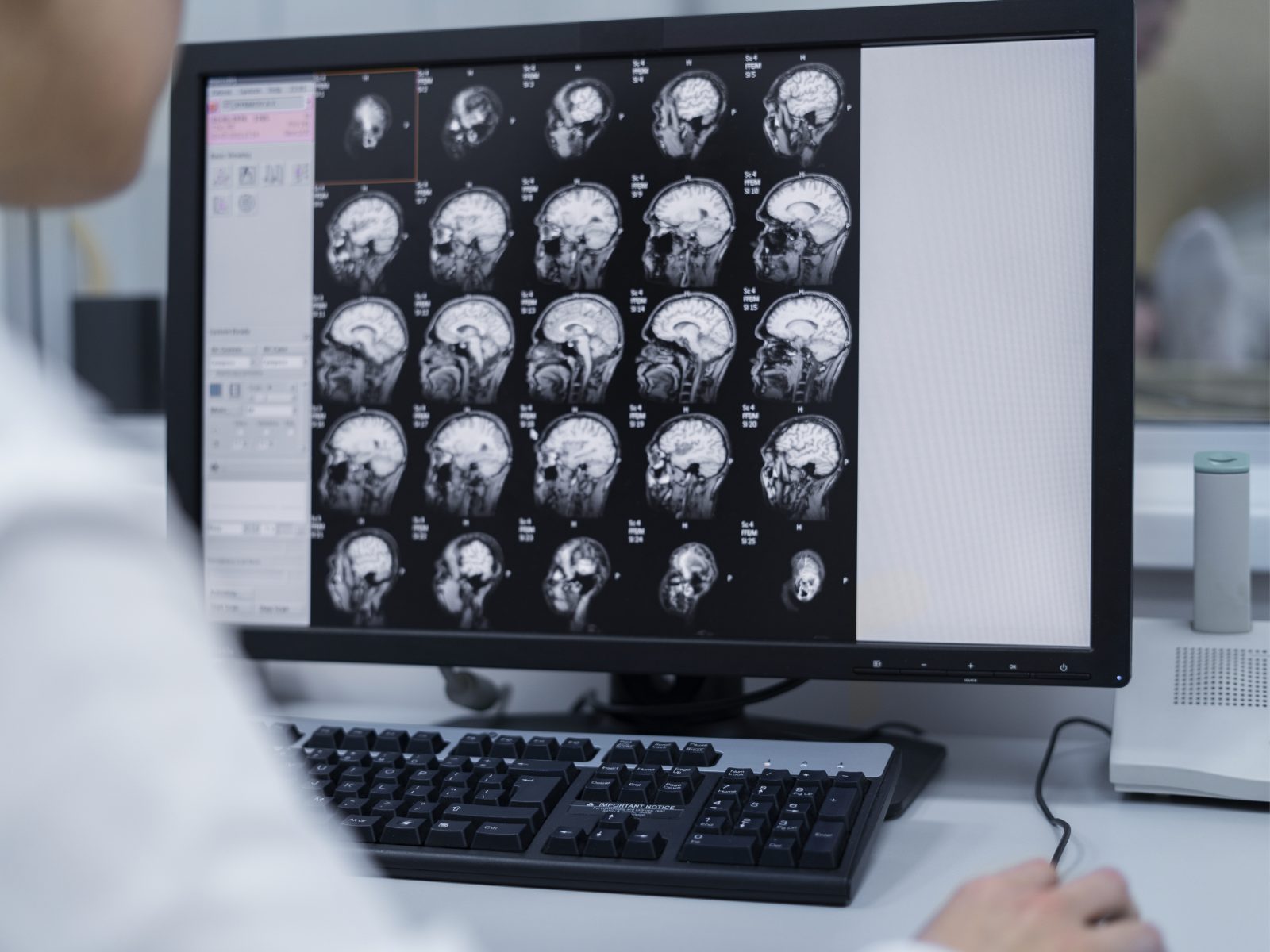 Neuroradiologie
