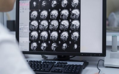 Neuroradiologie