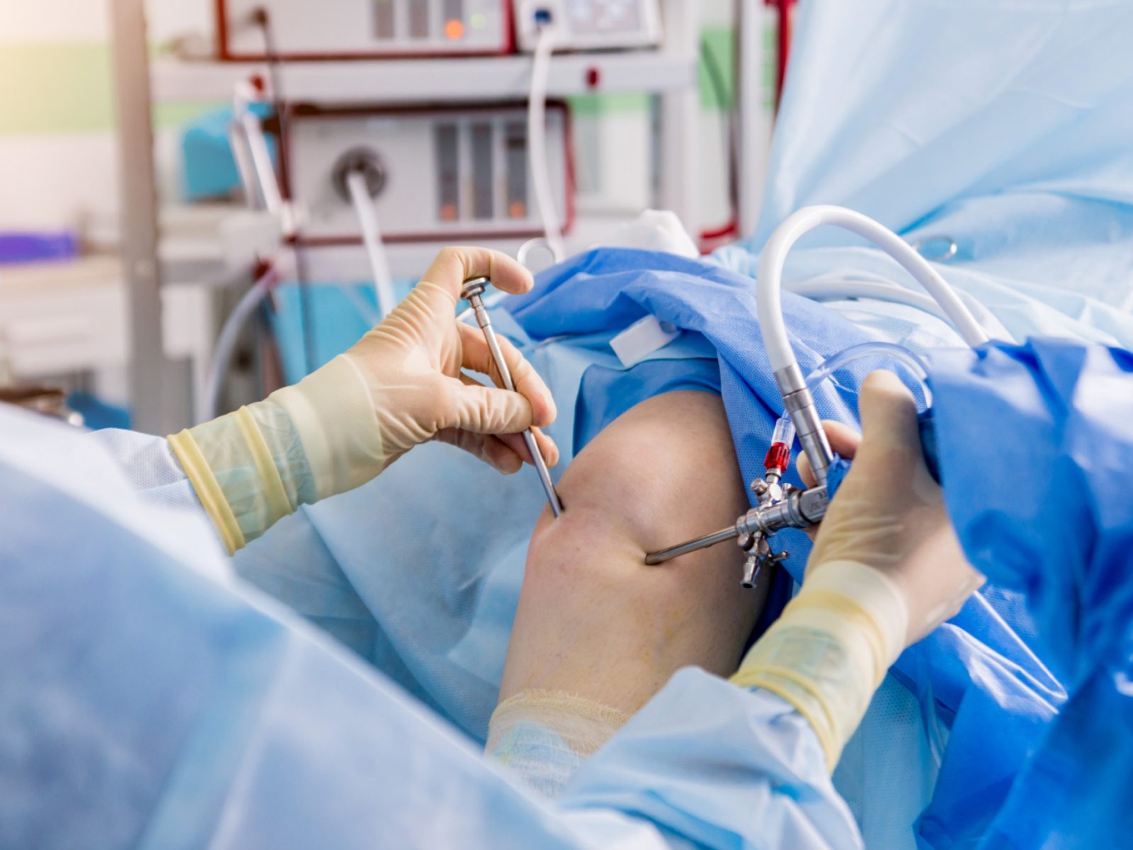 Chirurgie arthroscopique