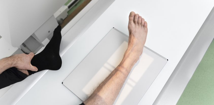 Radiographie du pied