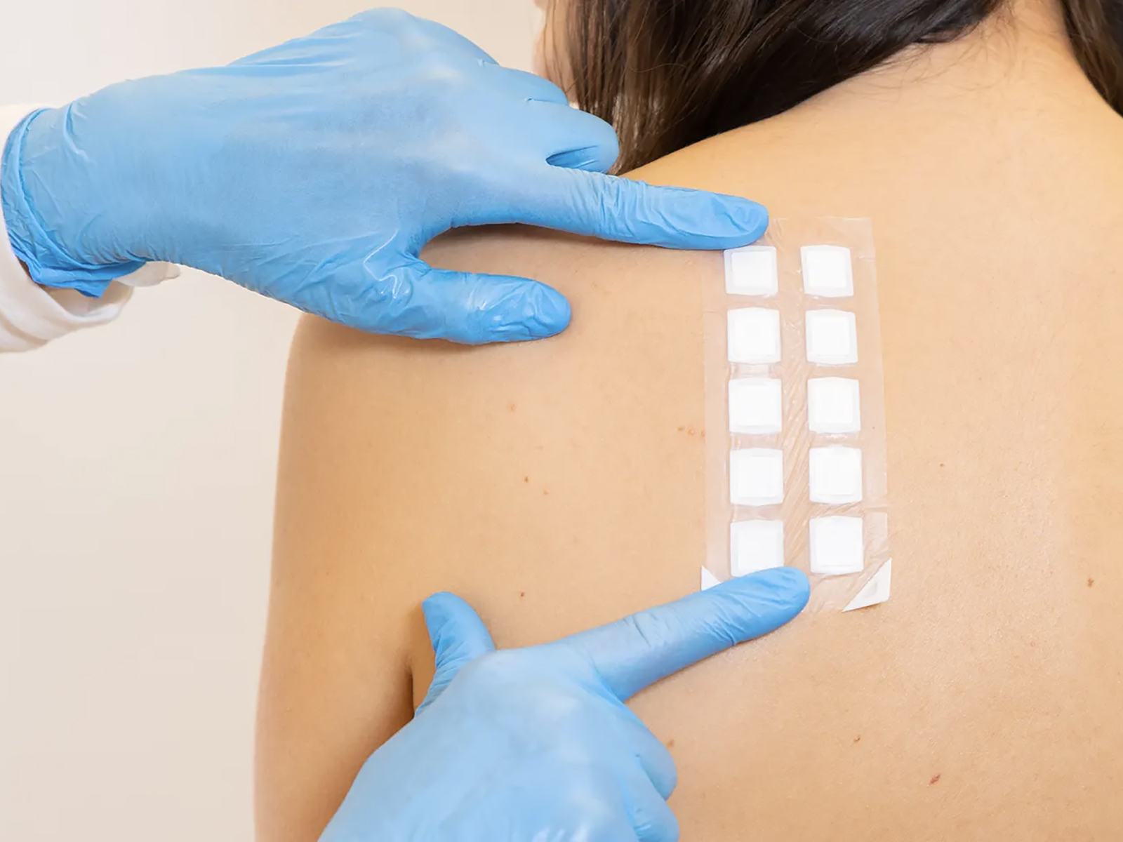 prick test