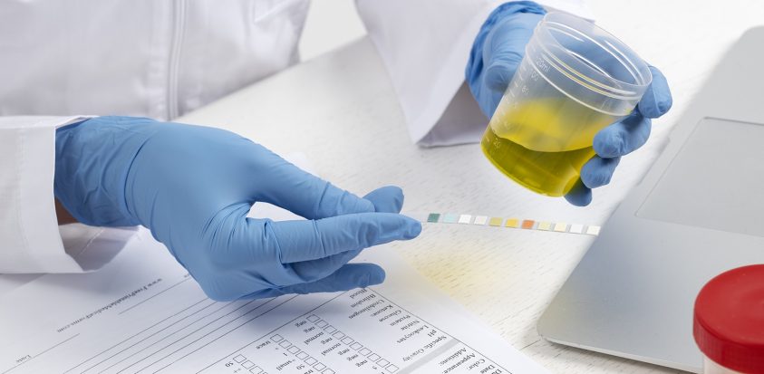 Test urinaire