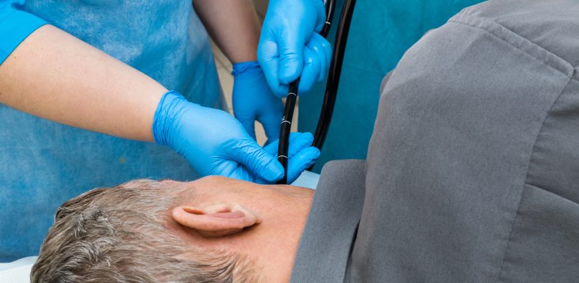 Insertion d'un tube d'endoscopie par la bouche