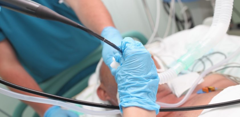 Insertion e l'endoscope par la bouche