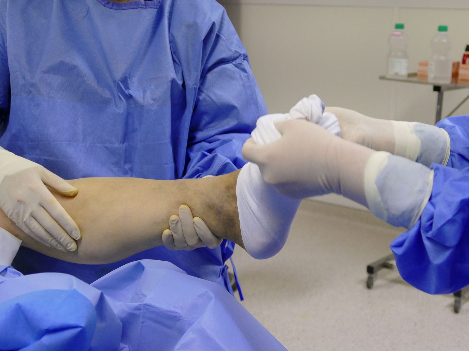 Traitement des varices